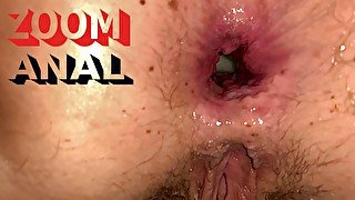 Pov Creampie Anal - Big Cum inside tight asshole - ARAB ANAL