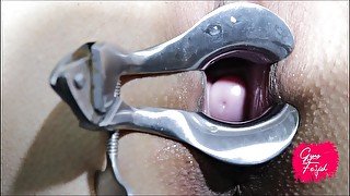 3 DIFFERENT SPECULUMS - GYNO FETISH