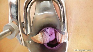 Gaped vagina of hot tempered granny Simira gets stretched with speculum