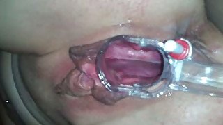 My perverted girlfriend is so addicted to her vaginal speculum