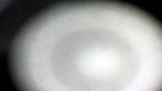 My sperm viewed in microscope