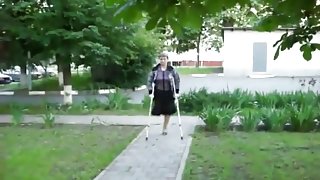 One legged woman