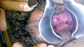 Puffy Pussy Speculum Play
